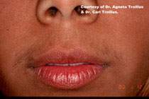 lip-voor2.jpg